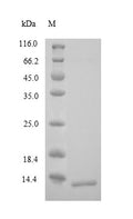 Recombinant Human Corticotropin-releasing factor receptor 1 (CRHR1), partial – Figure 1 of 1