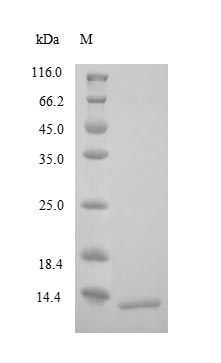 Recombinant Human Corticotropin-releasing factor receptor 1 (CRHR1), partial – Figure 1 of 1