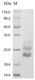 (Tris-Glycine gel) Discontinuous SDS-PAGE (reduced) with 5% enrichment gel and 15% separation gel.