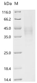 (Tris-Glycine gel) Discontinuous SDS-PAGE (reduced) with 5% enrichment gel and 15% separation gel.