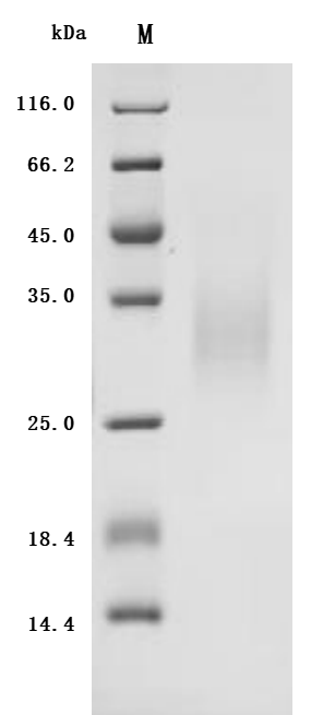 (Tris-Glycine gel) Discontinuous SDS-PAGE (reduced) with 5% enrichment gel and 15% separation gel.