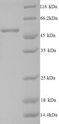 Recombinant Human Casein kinase I isoform epsilon (CSNK1E) – Figure 1 of 1