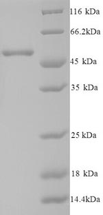 Recombinant Human Casein kinase I isoform epsilon (CSNK1E) – Figure 1 of 1