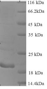Recombinant Human Cancer/testis antigen 1 (CTAG1A) – Figure 1 of 1