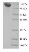 Recombinant Mouse Transcriptional repressor CTCFL (Ctcfl) – Figure 1 of 1