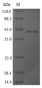 (Tris-Glycine gel) Discontinuous SDS-PAGE (reduced) with 5% enrichment gel and 15% separation gel.