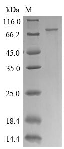 Recombinant Human CTP synthase 1 (CTPS1) – Figure 1 of 1
