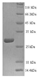 Recombinant Human Cathepsin K (CTSK) – Figure 1 of 1