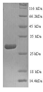 Recombinant Human Cathepsin K (CTSK) – Figure 1 of 1