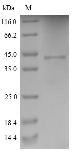 (Tris-Glycine gel) Discontinuous SDS-PAGE (reduced) with 5% enrichment gel and 15% separation gel.