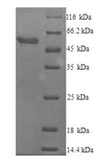 Recombinant Mouse Cytochrome P450 2E (Cyp2e1) – Figure 1 of 1