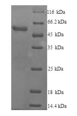 Recombinant Mouse Cytochrome P450 2E (Cyp2e1) – Figure 1 of 1
