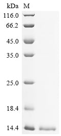 (Tris-Glycine gel) Discontinuous SDS-PAGE (reduced) with 5% enrichment gel and 15% separation gel.