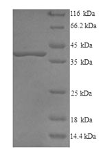 Recombinant Bovine Decorin (DCN) – Figure 1 of 1