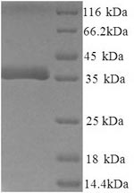 Recombinant Mouse Decorin (Dcn), partial – Figure 1 of 1