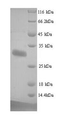 Recombinant Human Protein delta homolog 1 (DLK1), partial – Figure 1 of 1