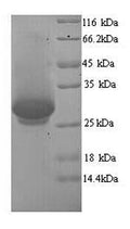 Recombinant Human Dynamin-1 (DNM1), partial – Figure 1 of 1