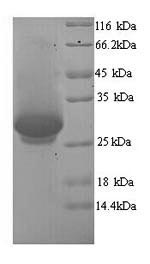 Recombinant Human Dynamin-1 (DNM1), partial – Figure 1 of 1