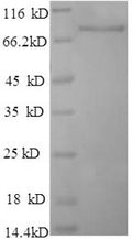 Recombinant Rat Dipeptidyl aminopeptidase-like protein 6 (DPP6), partial – Figure 1 of 1