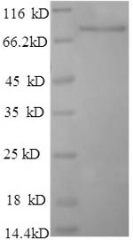 Recombinant Rat Dipeptidyl aminopeptidase-like protein 6 (DPP6), partial – Figure 1 of 1