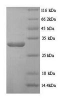 Recombinant Human Desmoplakin (DSP), partial – Figure 1 of 1