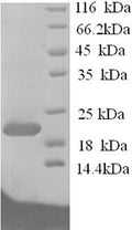 Recombinant Rat Ephrin-A1 (Efna1) – Figure 1 of 1
