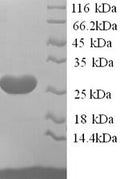 Recombinant Rat Ephrin-A5 (Efna5) – Figure 1 of 1