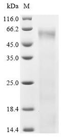 Recombinant Human Interferon-induced, double-stranded RNA-activated protein kinase (EIF2AK2) – Figure 1 of 1