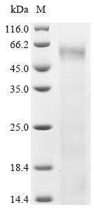 Recombinant Human Interferon-induced, double-stranded RNA-activated protein kinase (EIF2AK2) – Figure 1 of 1