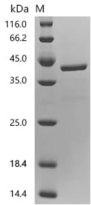(Tris-Glycine gel) Discontinuous SDS-PAGE (reduced) with 5% enrichment gel and 15% separation gel.