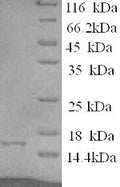 Recombinant Human Eukaryotic translation initiation factor 4E-binding protein 2 (EIF4EBP2) – Figure 1 of 1
