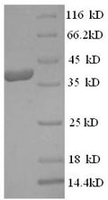 Recombinant Human Eukaryotic translation initiation factor 4 gamma 1 (EIF4G1), partial – Figure 1 of 1