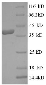 Recombinant Human Eukaryotic translation initiation factor 4 gamma 1 (EIF4G1), partial – Figure 1 of 1