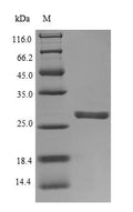 Recombinant Human Neutrophil elastase (ELANE) – Figure 1 of 1