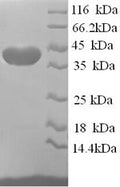 Recombinant Human ELAV-like protein 2 (ELAVL2), partial – Figure 1 of 1