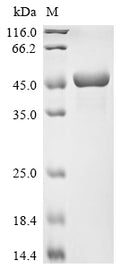 (Tris-Glycine gel) Discontinuous SDS-PAGE (reduced) with 5% enrichment gel and 15% separation gel.