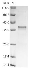 (Tris-Glycine gel) Discontinuous SDS-PAGE (reduced) with 5% enrichment gel and 15% separation gel.