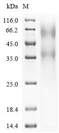Recombinant Human Transcriptional regulator ERG (ERG) – Figure 1 of 1