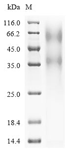 Recombinant Human Transcriptional regulator ERG (ERG) – Figure 1 of 1
