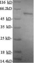 Recombinant Human Estrogen receptor beta (ESR2), partial – Figure 1 of 1