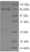 Recombinant Pig Electron transfer flavoprotein-ubiquinone oxidoreductase, mitochondrial (ETFDH) – Figure 1 of 1