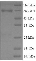 Recombinant Pig Electron transfer flavoprotein-ubiquinone oxidoreductase, mitochondrial (ETFDH) – Figure 1 of 1