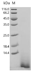 (Tris-Glycine gel) Discontinuous SDS-PAGE (reduced) with 5% enrichment gel and 15% separation gel.
