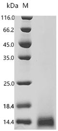 (Tris-Glycine gel) Discontinuous SDS-PAGE (reduced) with 5% enrichment gel and 15% separation gel.