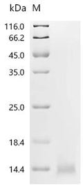 (Tris-Glycine gel) Discontinuous SDS-PAGE (reduced) with 5% enrichment gel and 15% separation gel.