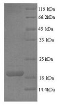 Recombinant Human Tumor necrosis factor ligand superfamily member 6 (FASLG), partial – Figure 1 of 1