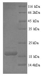 Recombinant Human Tumor necrosis factor ligand superfamily member 6 (FASLG), partial – Figure 1 of 1