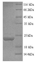 Recombinant Human Tumor necrosis factor ligand superfamily member 6 (FASLG), partial – Figure 1 of 1