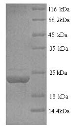 Recombinant Human Tumor necrosis factor ligand superfamily member 6 (FASLG), partial – Figure 1 of 1