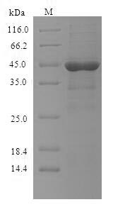 (Tris-Glycine gel) Discontinuous SDS-PAGE (reduced) with 5% enrichment gel and 15% separation gel.